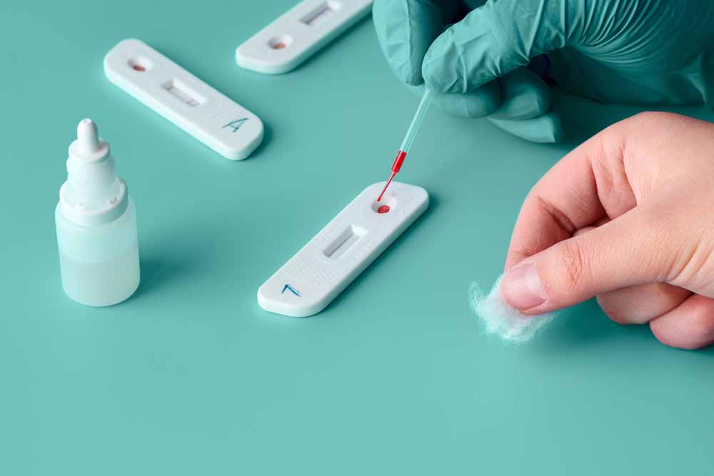 SEFAC actualiza la formación para realizar test de detección de coronavirus