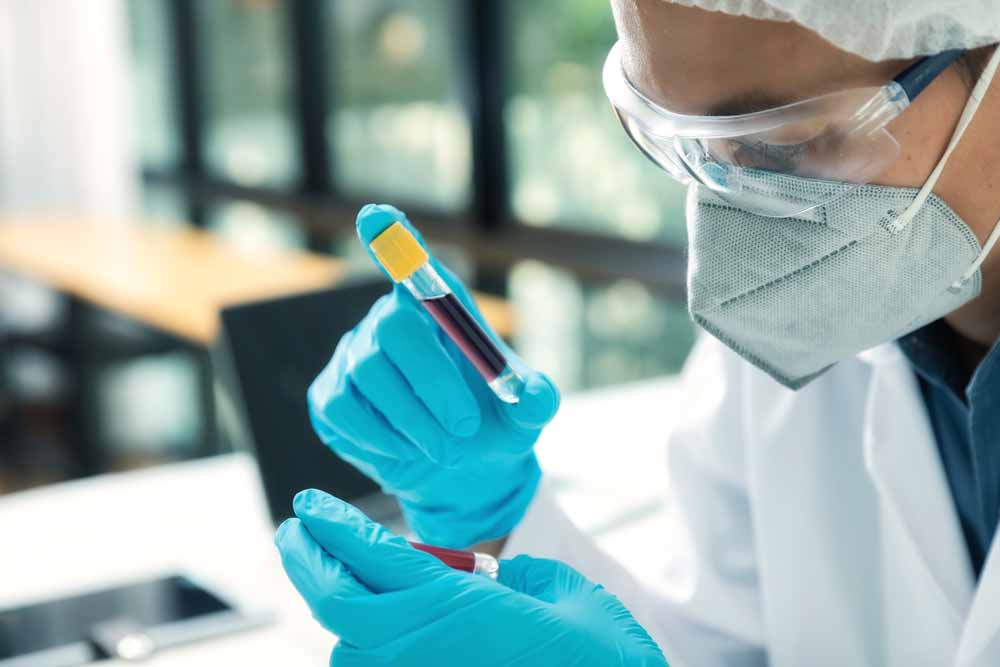 Un 8,5% de farmacéuticos madrileños tiene anticuerpos frente a SARS-CoV-2