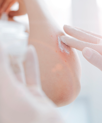 Cuidado de la piel en la farmacia: consejos y tratamientos