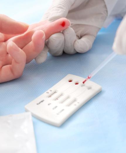 La prevención y tratamiento del SIDA desde la oficina de farmacia 