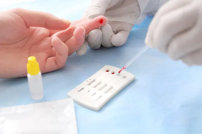 La prevención y tratamiento del SIDA desde la oficina de farmacia La prevención y tratamiento del SIDA desde la oficina de farmacia