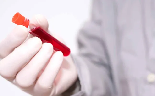 Muestra de sangre prueba-de-sangre