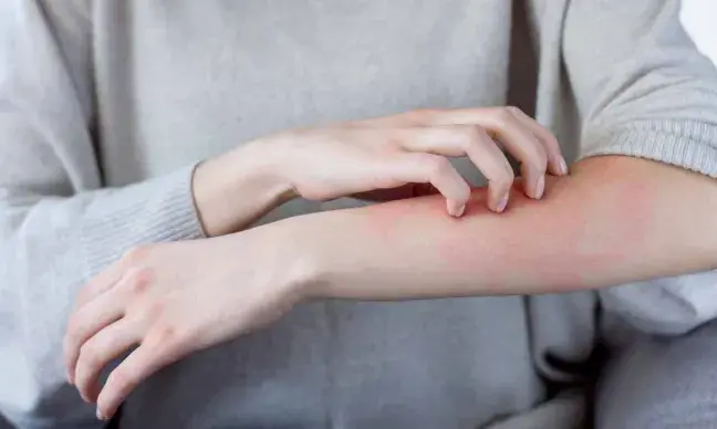 Picor en el brazo picor-en-el-brazo